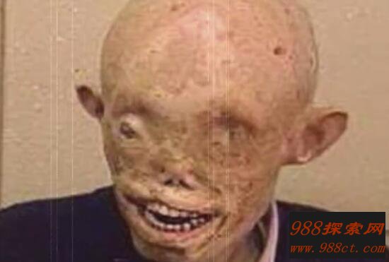 日本核辐射下的变异人