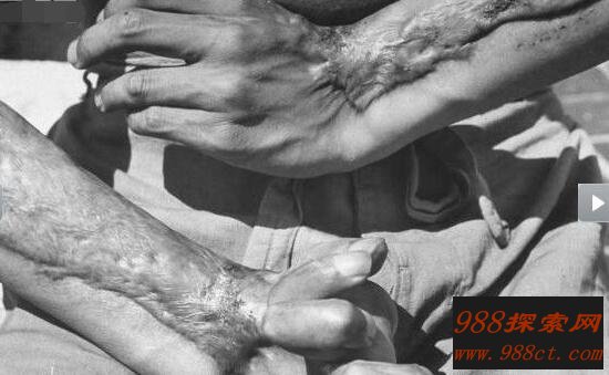 日本核辐射下的变异人