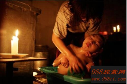 福岛核电站的变异婴儿